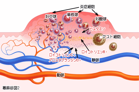 じんましん発症システム2