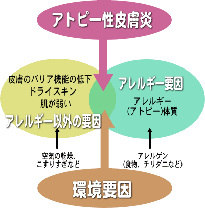 アトピー性皮膚炎の2っの要因